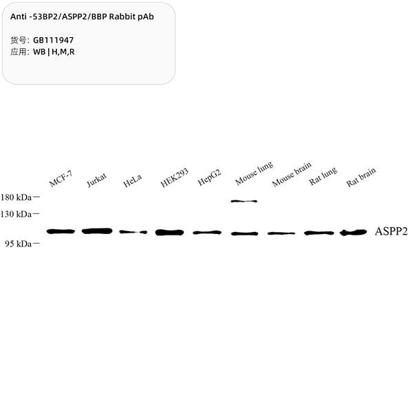 Антитела первичные, поликлональные, 53BP2/ASPP2/BBP, 100 мкл