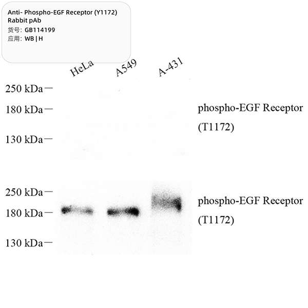 Антитела первичные, поликлональные, Phospho-EGF Receptor (T1172), 100 мкл