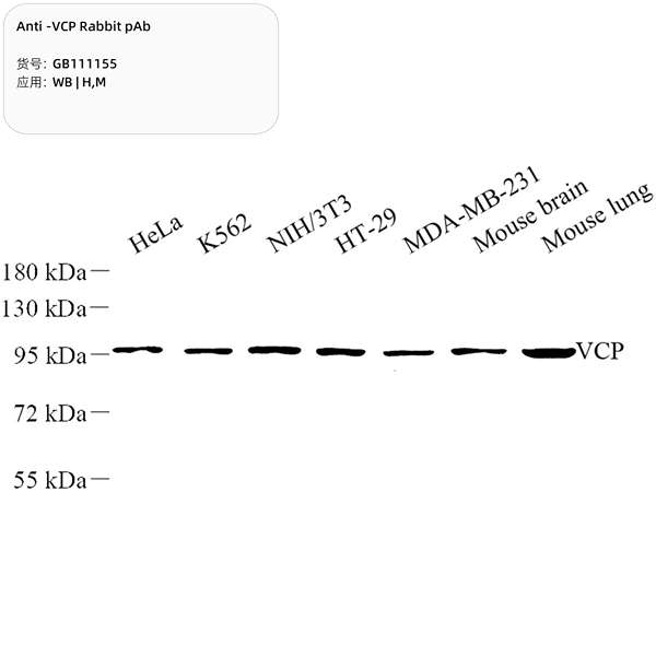 Антитела первичные, поликлональные, VCP, 100 мкл