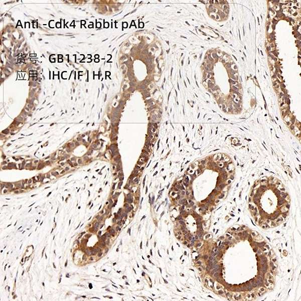 Антитела первичные, поликлональные, Cdk4, 100 мкл