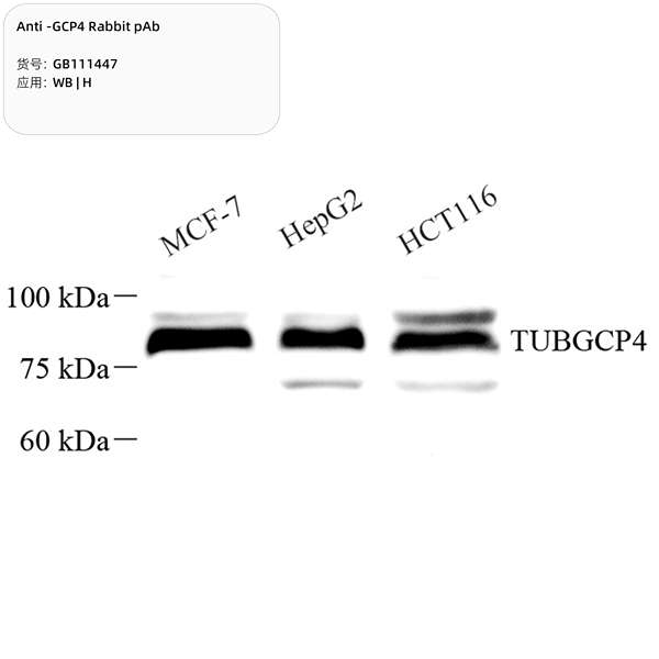 Антитела первичные, поликлональные, GCP4, 100 мкл