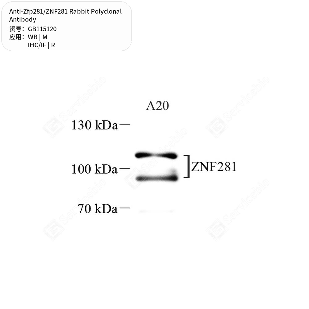 Антитела первичные, поликлональные кролика к Zfp281/ZNF281 крысы, мыши, 100 мкл
