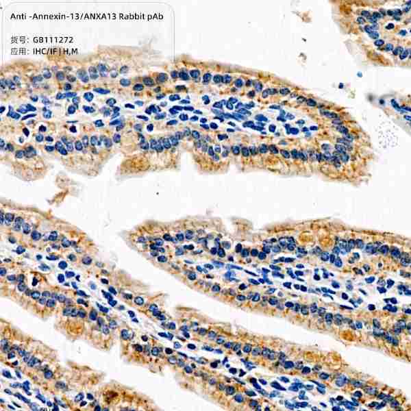 Антитела первичные, поликлональные, Annexin-13/ANXA13, 100 мкл
