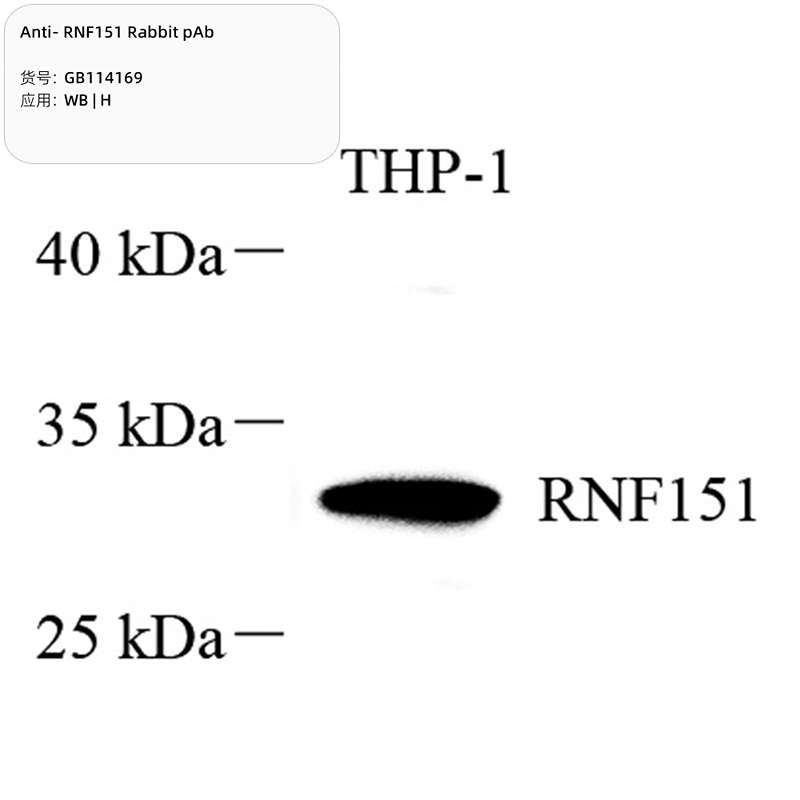 Антитела первичные, поликлональные, RNF151, 100 мкл