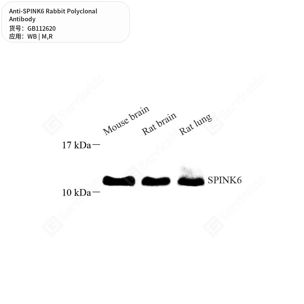 Антитела первичные, поликлональные кролика к SPINK6 крысы, мыши, 100 мкл