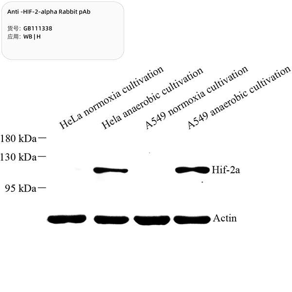 Антитела первичные, поликлональные, HIF-2-alpha, 100 мкл