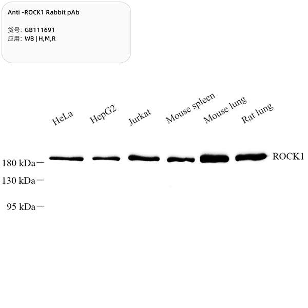 Антитела первичные, поликлональные, ROCK1, 100 мкл