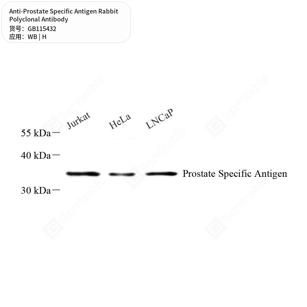 Антитела первичные, поликлональные кролика к Prostate Specific Antigen человека, 100 мкл