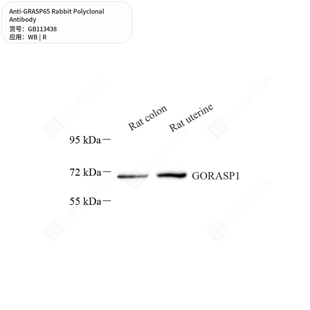 Антитела первичные, поликлональные кролика к GRASP65 крысы, 50 мкл