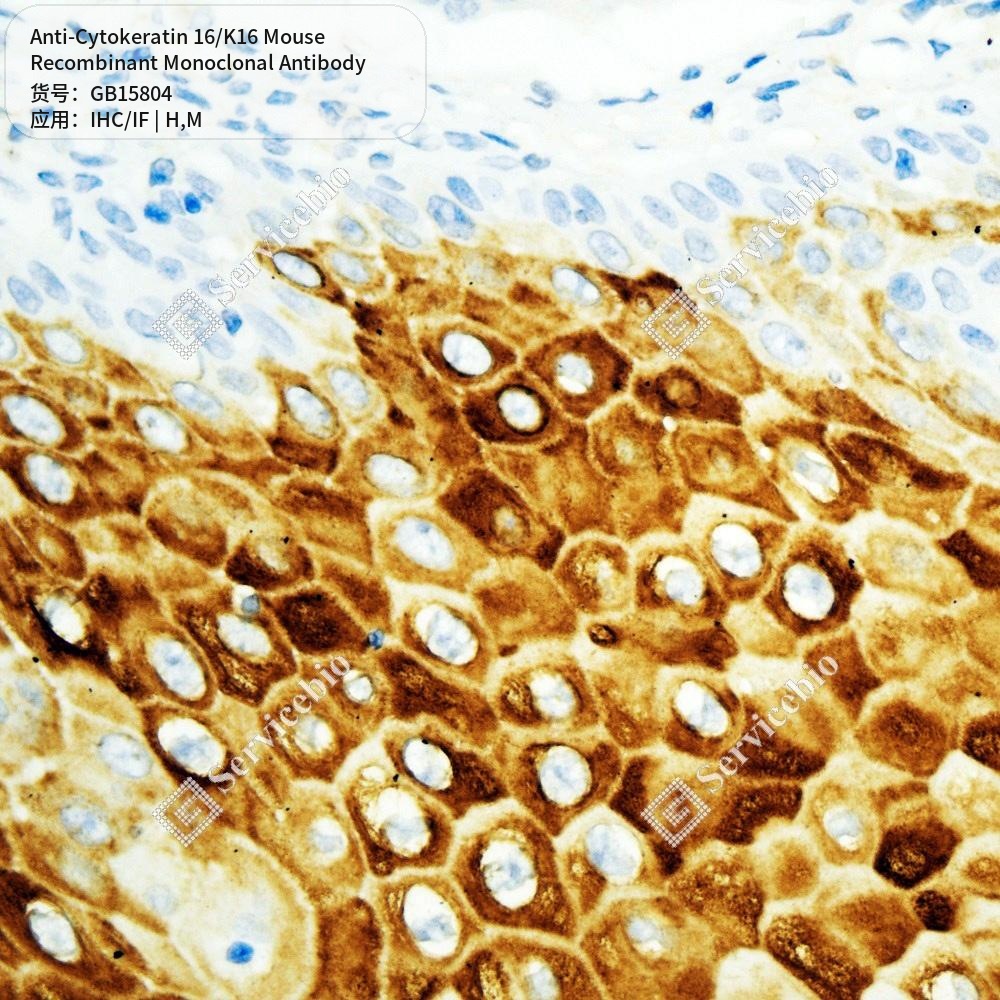 Антитела первичные, моноклональные мыши к Cytokeratin 16/K16 мыши, человека, 100 мкл