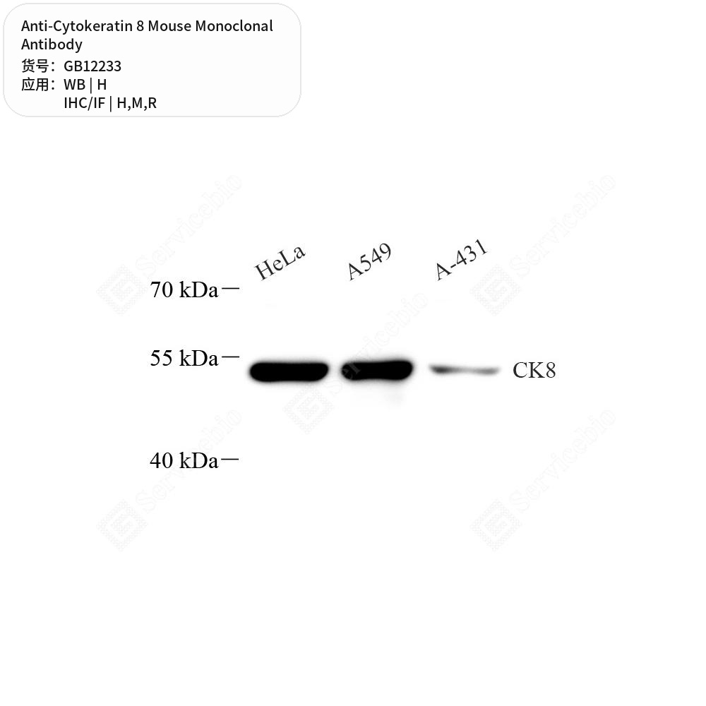 Антитела первичные, моноклональные мыши к Cytokeratin 8 крысы, мыши, человека, 50 мкл