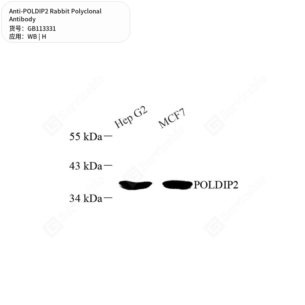 Антитела первичные, поликлональные кролика к POLDIP2 человека, 50 мкл
