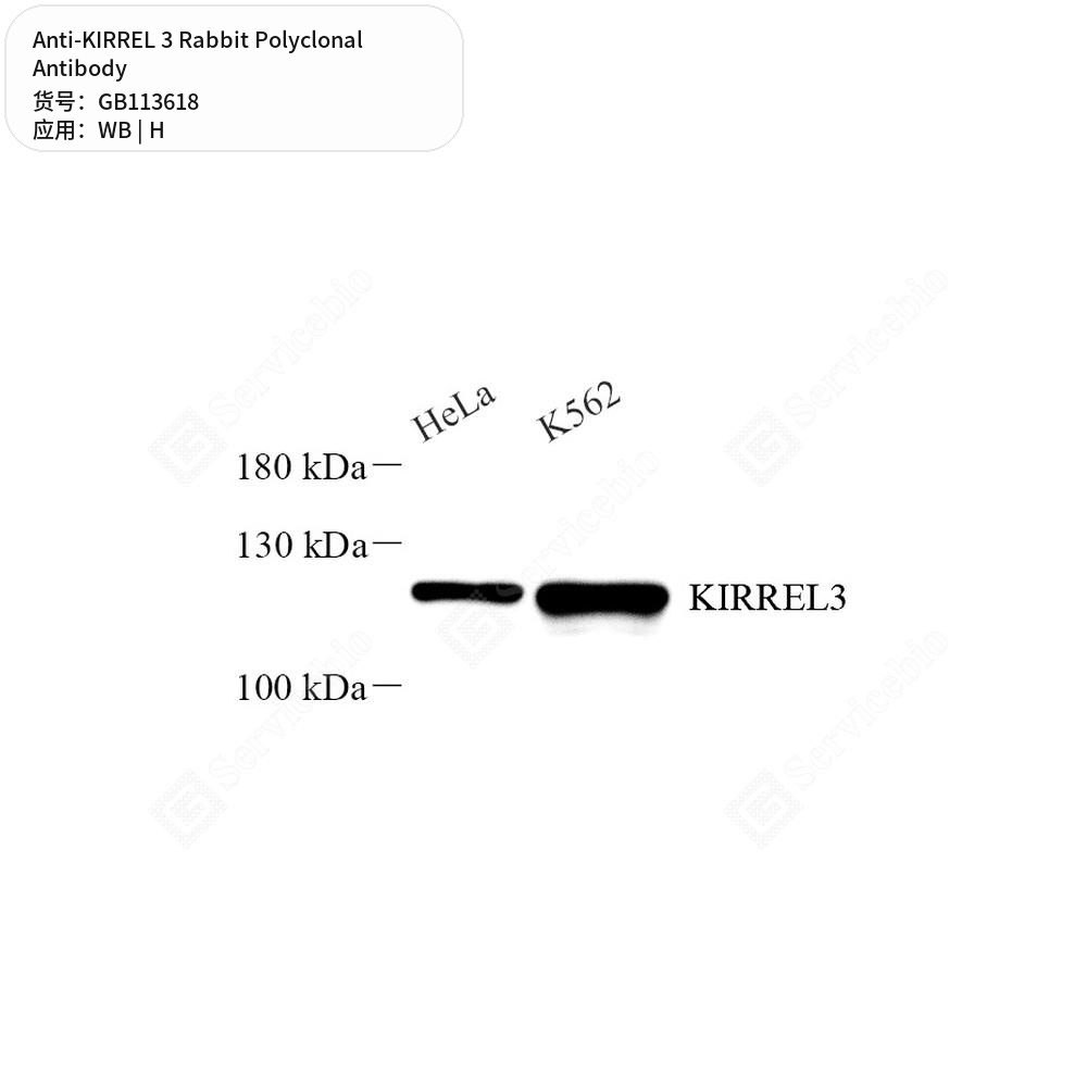 Антитела первичные, поликлональные кролика к KIRREL 3 человека, 100 мкл