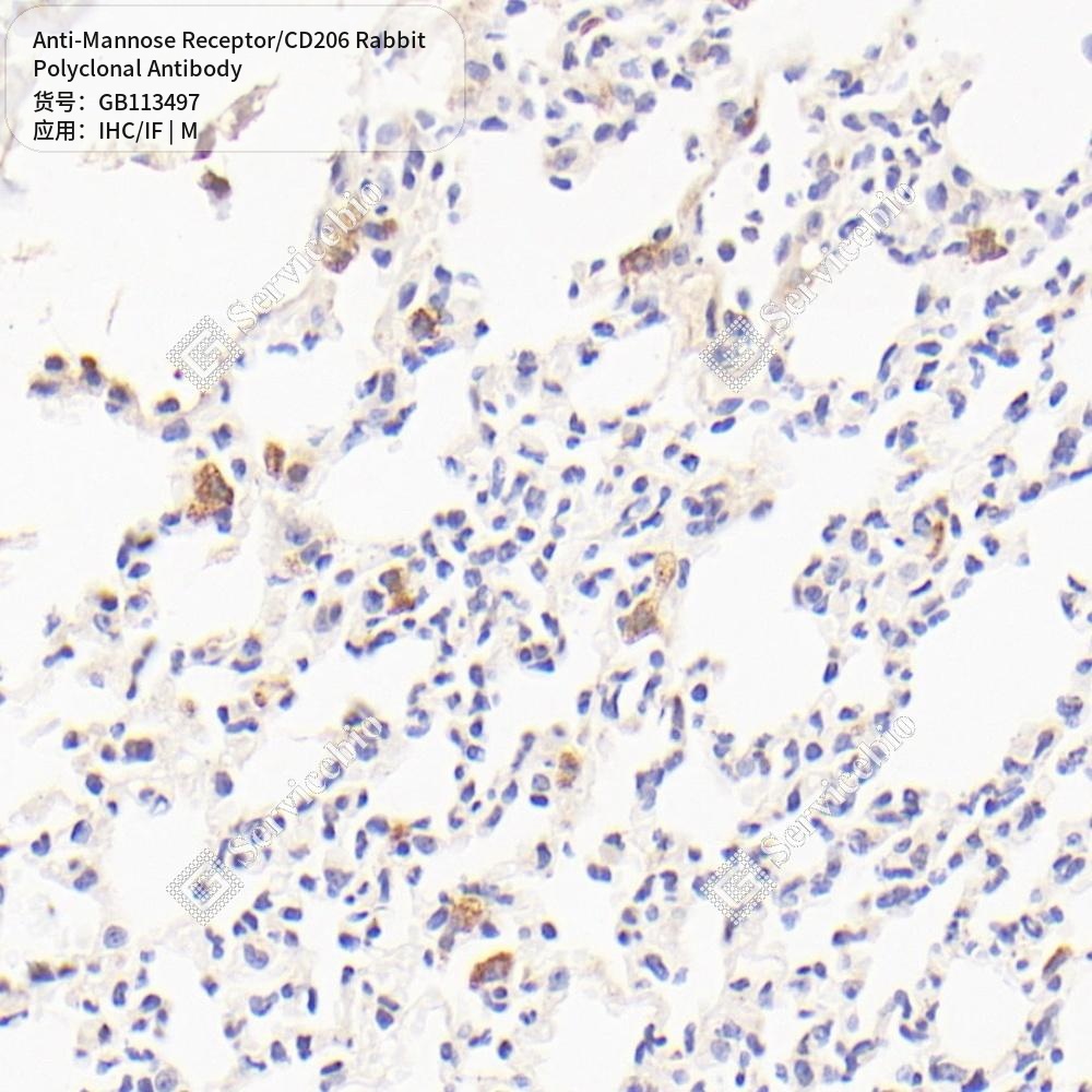Антитела первичные, поликлональные кролика к Mannose Receptor/CD206 мыши, 50 мкл