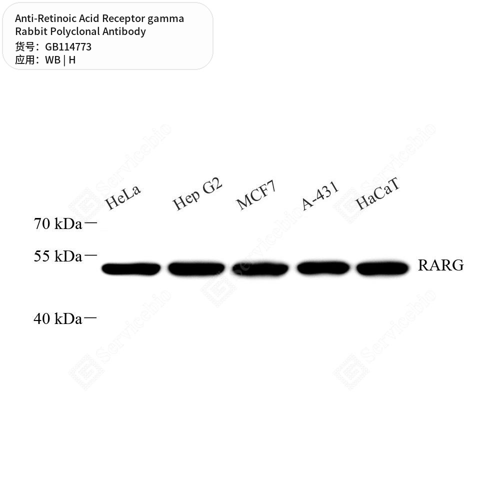 Антитела первичные, поликлональные кролика к Retinoic Acid Receptor gamma человека, 50 мкл