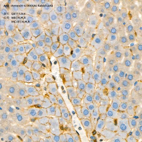 Антитела первичные, поликлональные, Annexin-6/ANXA6, 100 мкл