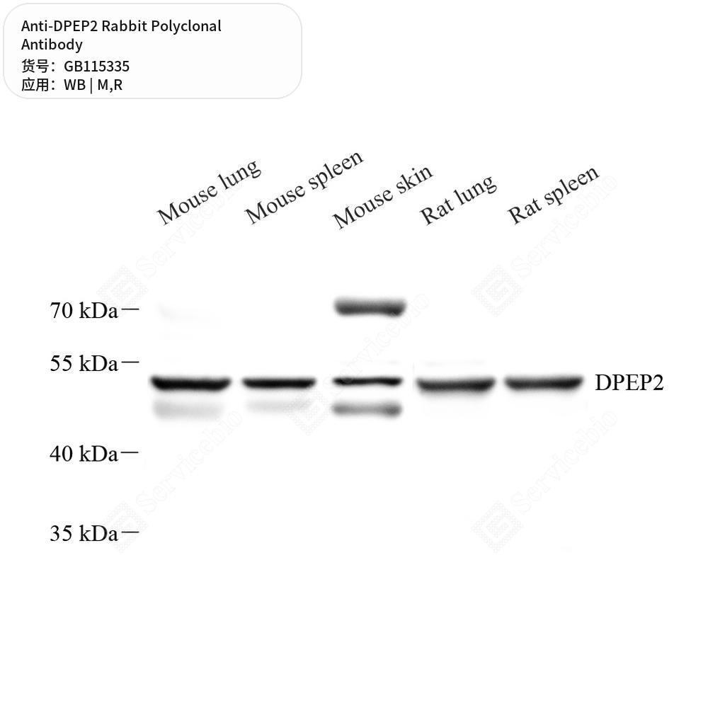 Антитела первичные, поликлональные кролика к DPEP2 крысы, мыши, 50 мкл