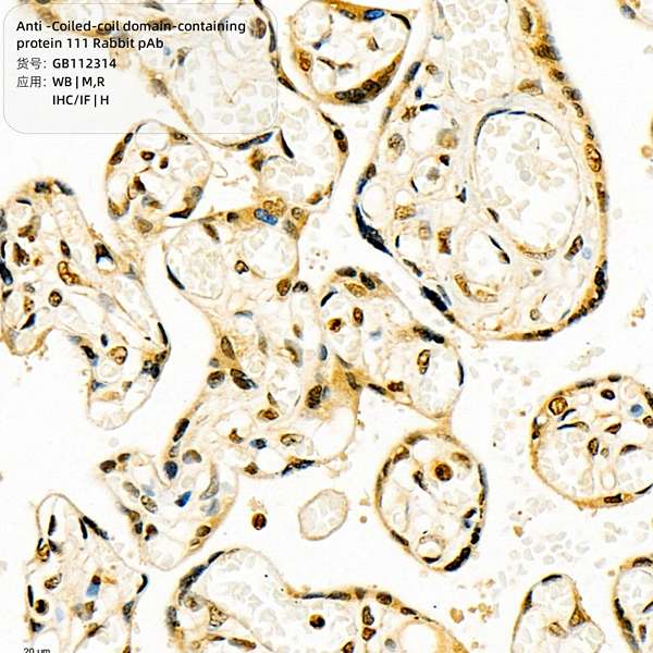 Антитела первичные, поликлональные, Coiled-coil domain-containing protein 111, 100 мкл