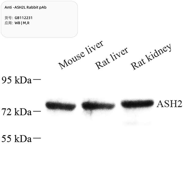 Антитела первичные, поликлональные, ASH2L, 100 мкл