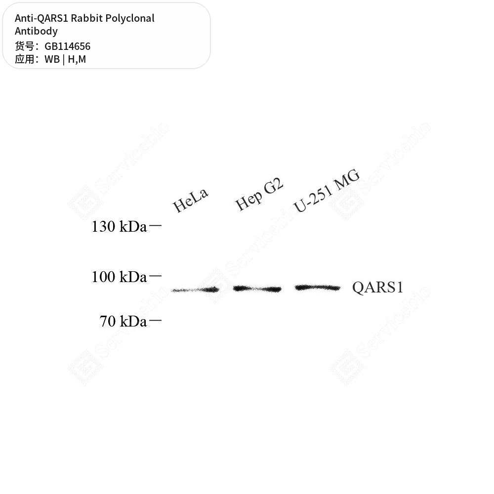 Антитела первичные, поликлональные кролика к QARS1 мыши, человека, 50 мкл