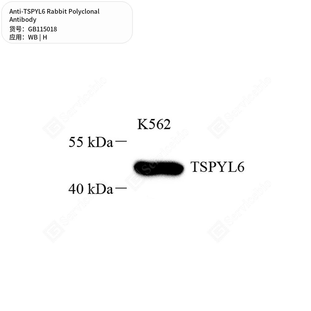 Антитела первичные, поликлональные кролика к TSPYL6 человека, 50 мкл
