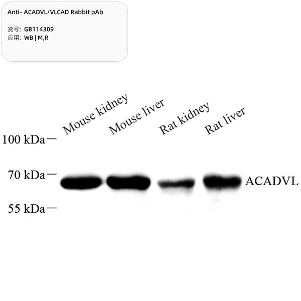 Антитела первичные, поликлональные, ACADVL/VLCAD, 100 мкл