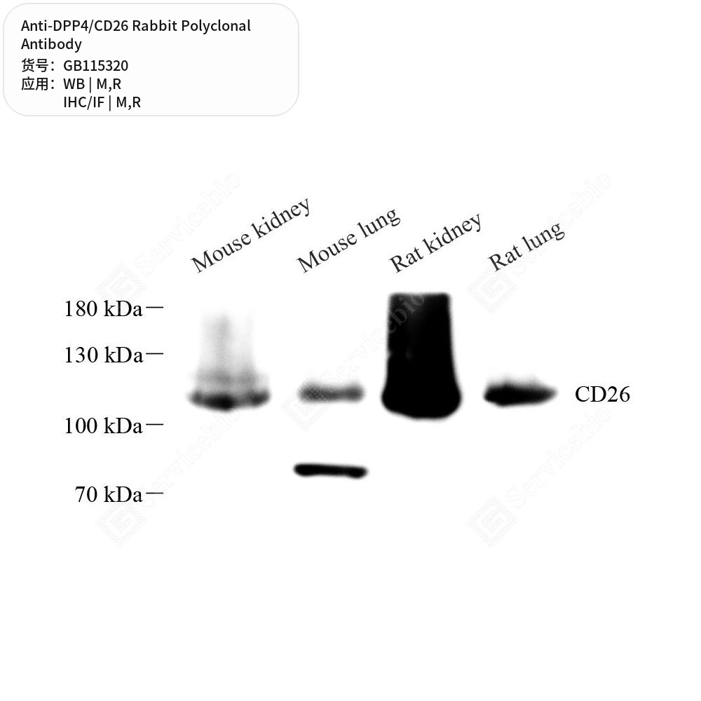 Антитела первичные, поликлональные кролика к DPP4/CD26 крысы, мыши, 50 мкл