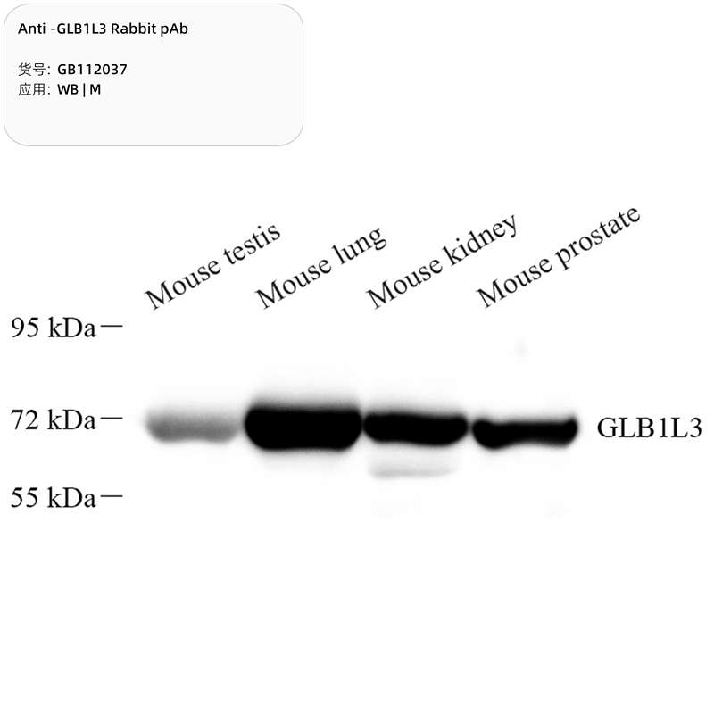 Антитела первичные, поликлональные, GLB1L3, 100 мкл