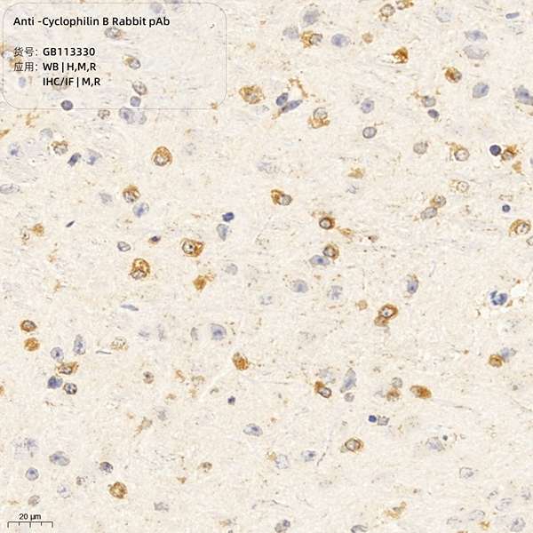 Антитела первичные, поликлональные, Cyclophilin B, 100 мкл
