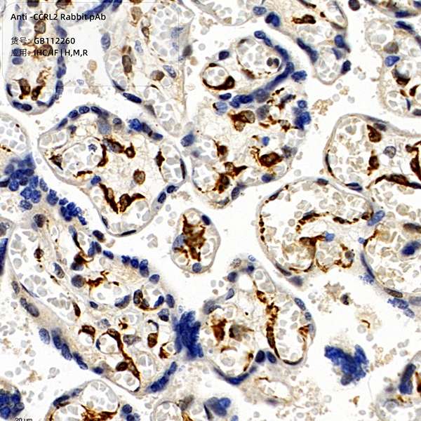 Антитела первичные, поликлональные, CCRL2, 100 мкл