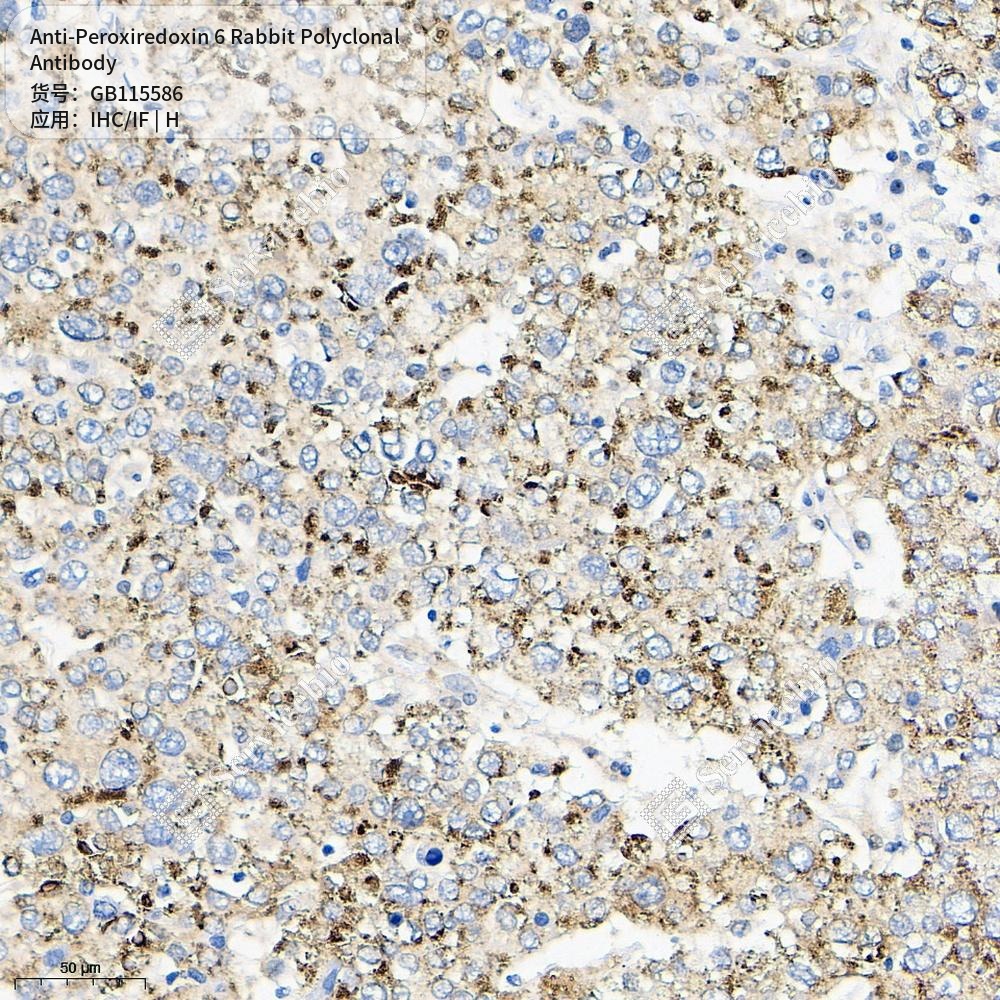 Антитела первичные, поликлональные кролика к Peroxiredoxin 6 человека, 50 мкл