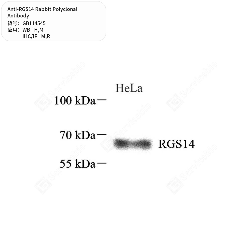 Антитела первичные, поликлональные кролика к RGS14 крысы, мыши, человека, 100 мкл