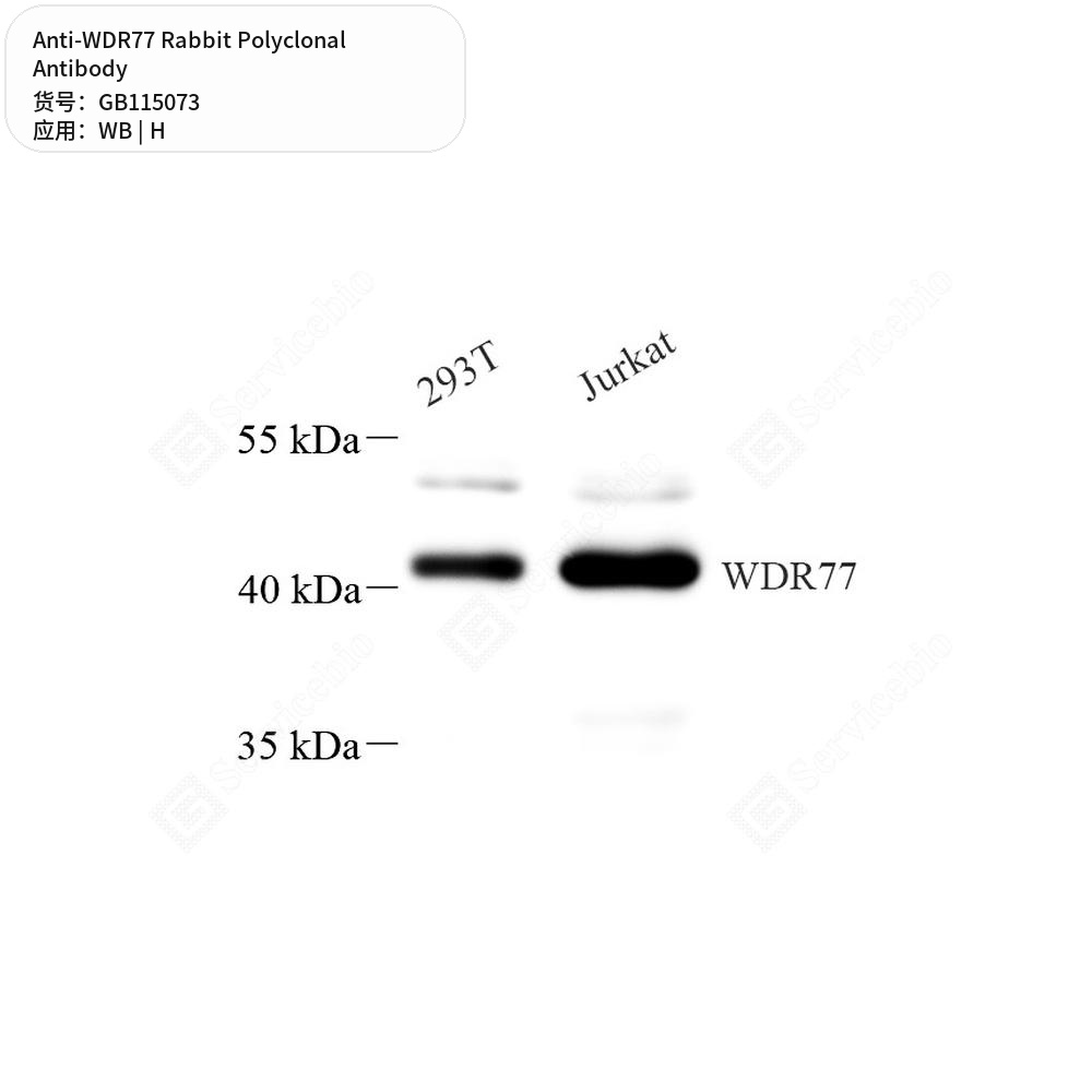 Антитела первичные, поликлональные кролика к WDR77 человека, 100 мкл