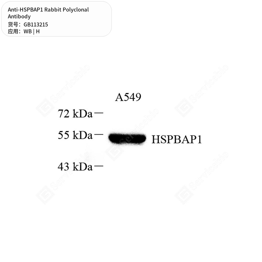 Антитела первичные, поликлональные кролика к HSPBAP1 человека, 100 мкл