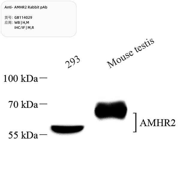 Антитела первичные, поликлональные, AMHR2, 100 мкл