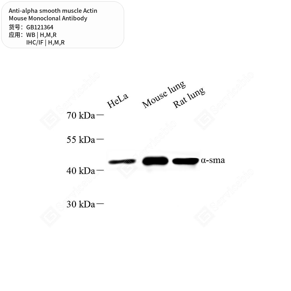 Антитела первичные, моноклональные мыши к alpha smooth muscle Actin крысы, мыши, человека, 50 мкл