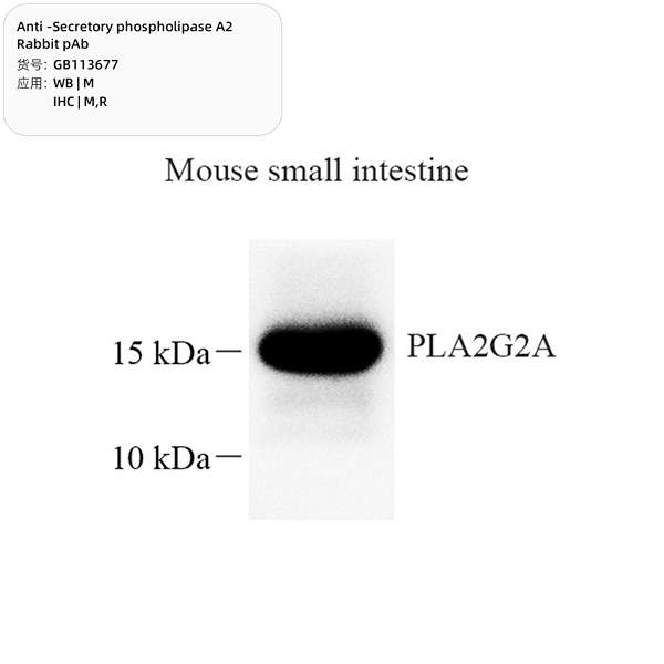 Антитела первичные, поликлональные, Secretory phospholipase A2, 100 мкл