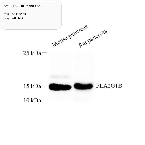 Антитела первичные, поликлональные, PLA2G1B, 100 мкл