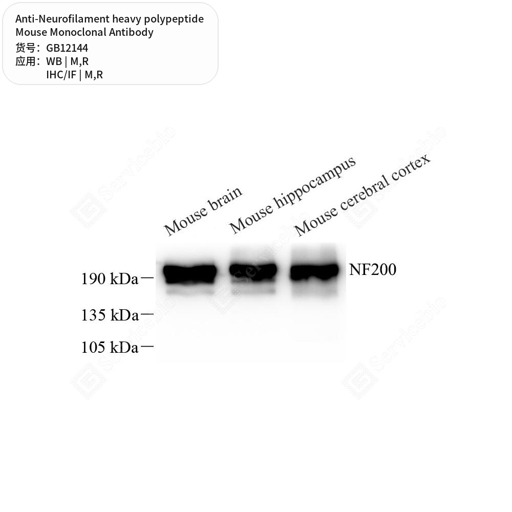 Антитела первичные, моноклональные мыши к Neurofilament heavy polypeptide крысы, мыши, 50 мкл