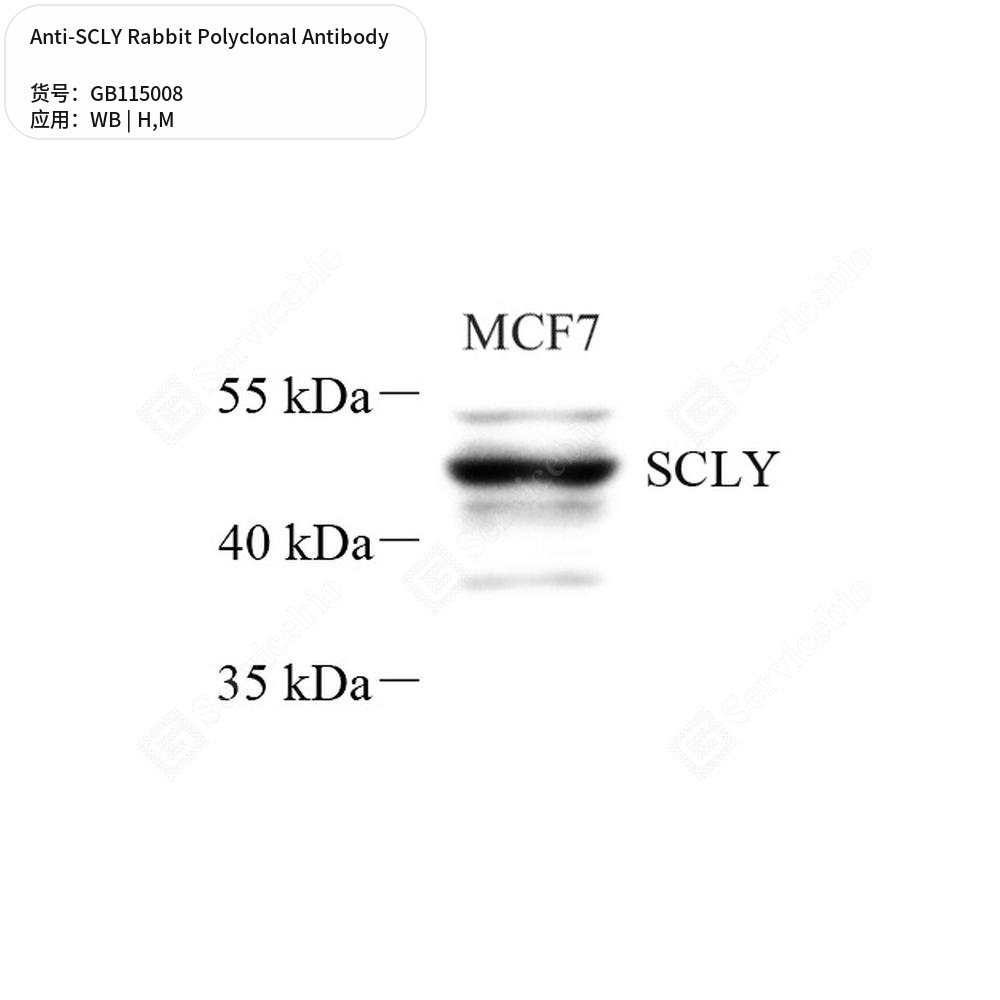 Антитела первичные, поликлональные кролика к SCLY мыши, человека, 50 мкл
