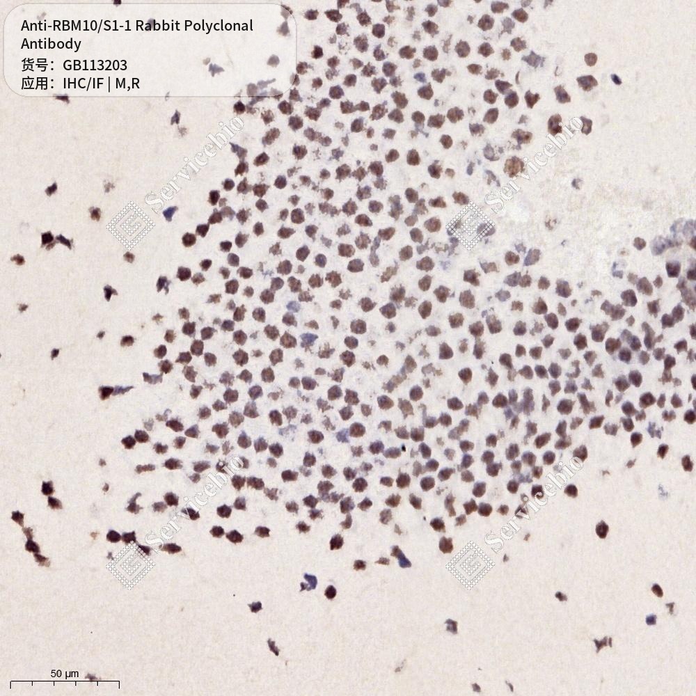 Антитела первичные, поликлональные кролика к RBM10/S1-1 крысы, мыши, 50 мкл