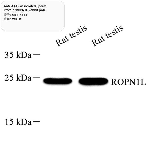 Антитела первичные, поликлональные, AKAP associated Sperm Protein/ROPN1L, 100 мкл