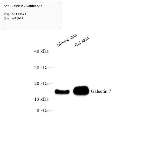 Антитела первичные, поликлональные, Galectin 7, 100 мкл