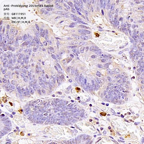 Антитела первичные, поликлональные, Proteasome 20S beta 6, 100 мкл