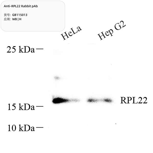Антитела первичные, поликлональные, RPL22, 100 мкл