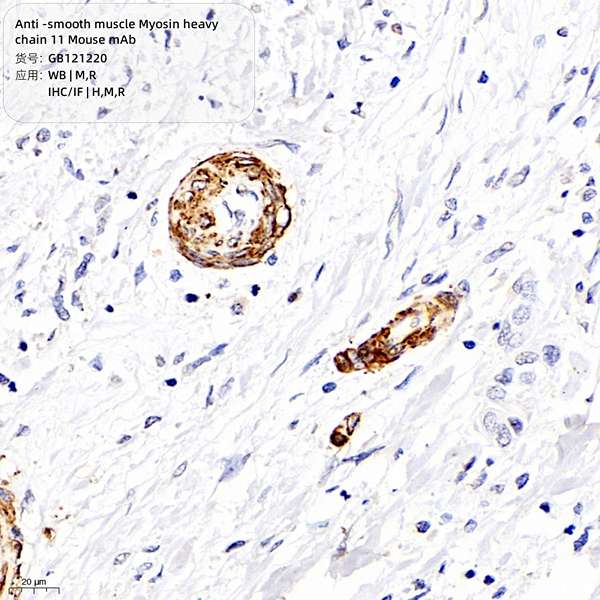 Антитела первичные, моноклональные, smooth muscle Myosin heavy chain 11, 100 мкл