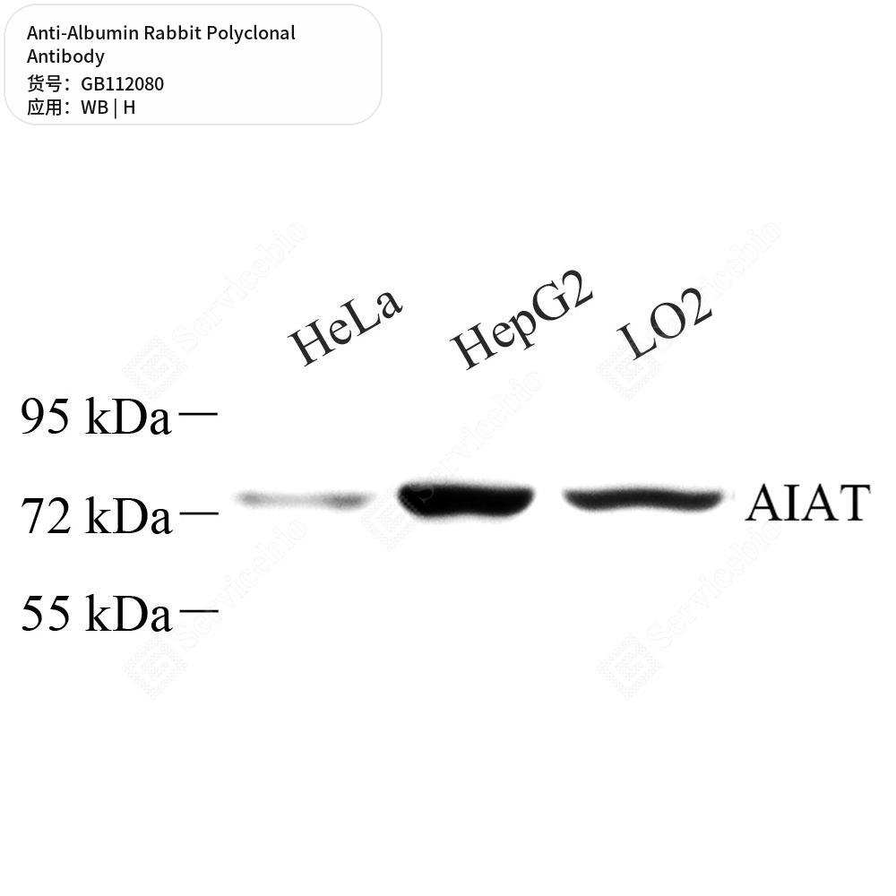Антитела первичные, поликлональные кролика к Albumin человека, 50 мкл