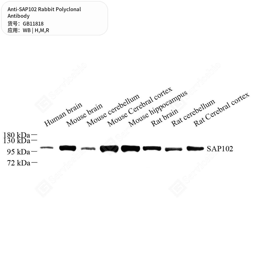 Антитела первичные, поликлональные кролика к SAP102 крысы, мыши, человека, 100 мкл