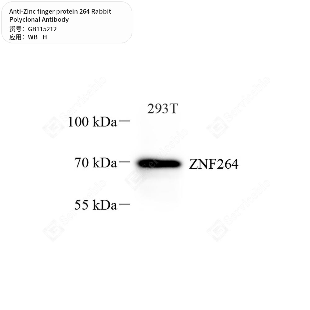 Антитела первичные, поликлональные кролика к Zinc finger protein 264 человека, 50 мкл