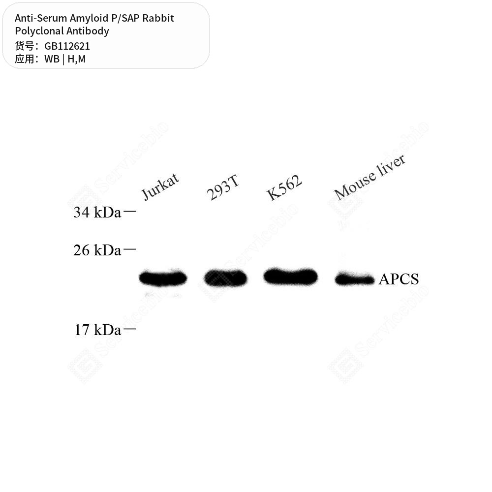 Антитела первичные, поликлональные кролика к Serum Amyloid P/SAP мыши, человека, 100 мкл